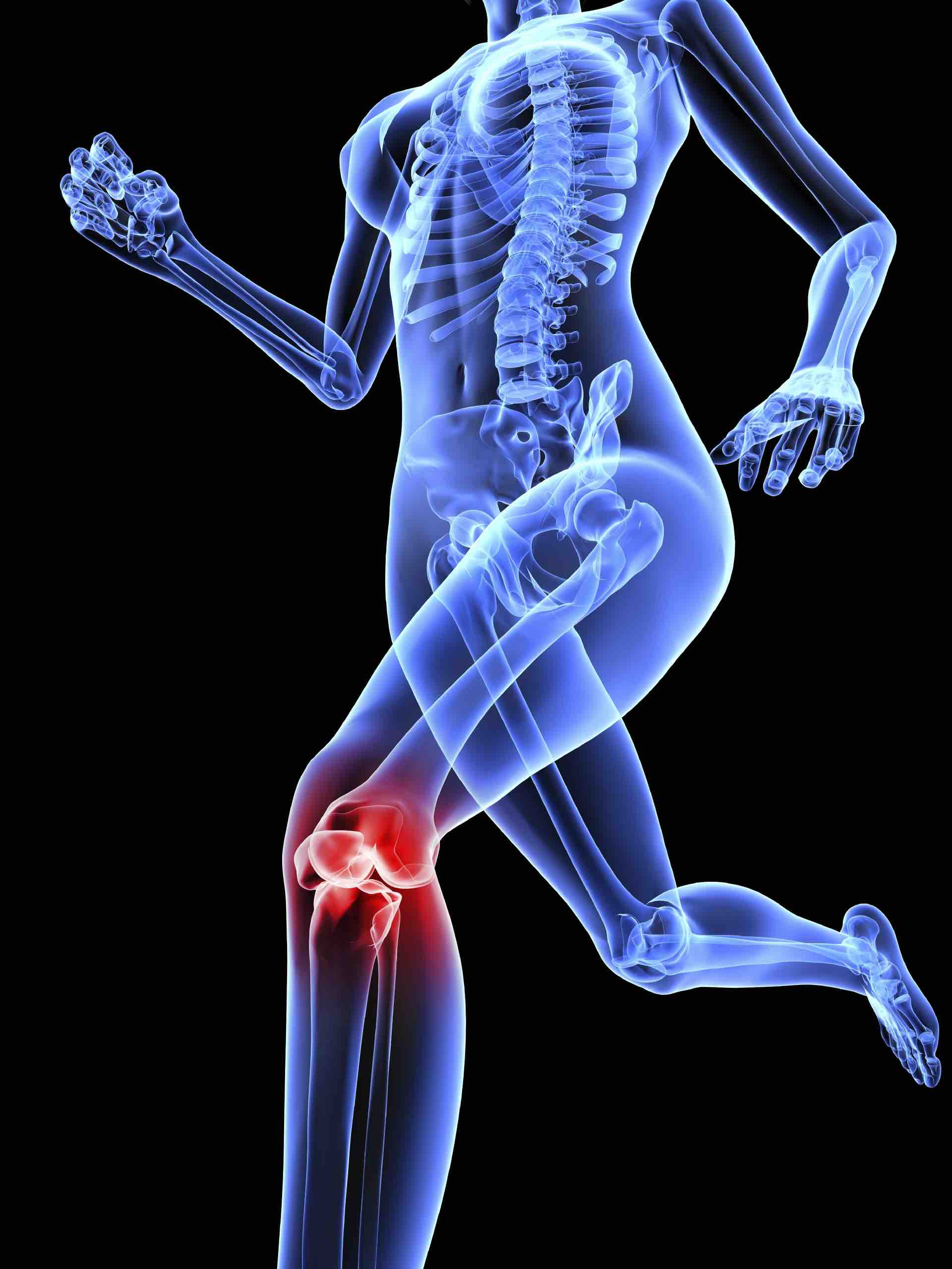 Using Sesame Seeds is Superior to Tylenol for Knee Arthritis